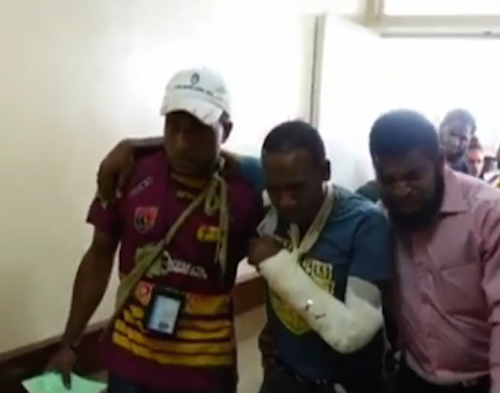 A wounded student after treatment for gunshot wounds yesterday in the confrontation between police and students at the University of PNG. Reports today said 23 people had been wounded or injured. Image: EMTV News