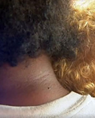 NZ and Pacific countries contest Asian influence for WHO regional director