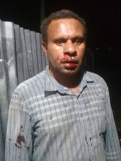 A Papuan freelance journalist John Pakage, who was reportedly beaten by members of the Indonesian Mobile Brigade Corps and his family threatened. Image: Wenslaus