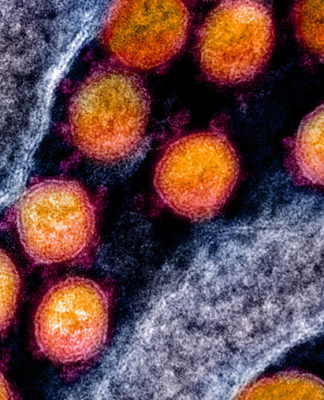 14,000 could die in NZ if control efforts fail, says new report