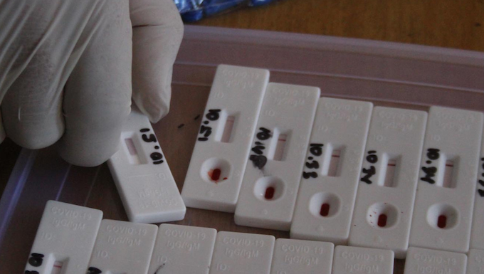 Covid-19 rapid tests