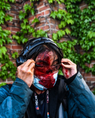 Blamed on covid-19 pandemic
