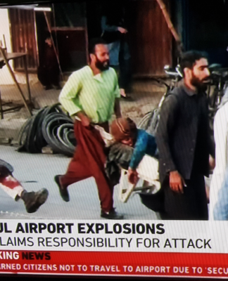 Kabul Airport suicide bombing wounded