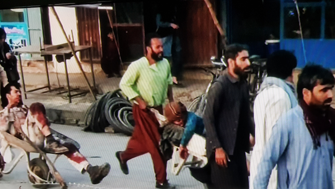 Kabul Airport suicide bombing wounded