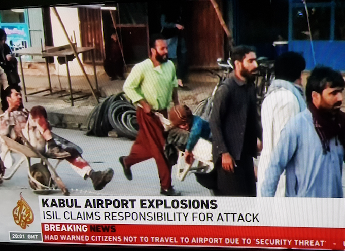 Kabul Airport suicide bombing wounded