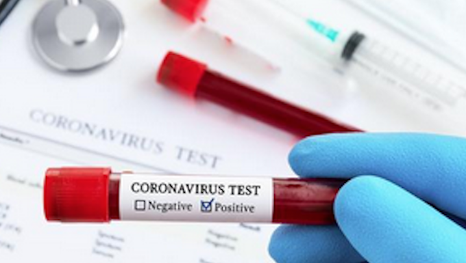 Tonga's first covid-19 positive case