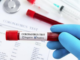 Tonga's first covid-19 positive case