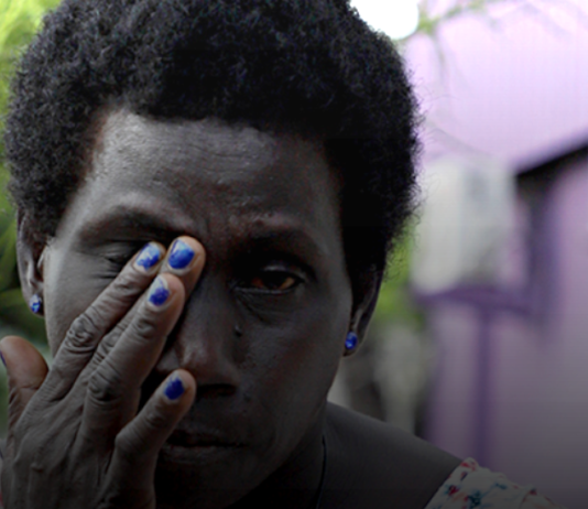 Beatings survivor Gathy Peter