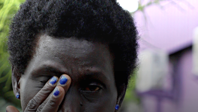 Beatings survivor Gathy Peter