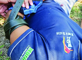 The wounded NBC journalist near Port Moresby 2 August 2023