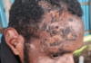 Tortured 19-year-old Gira Gwijangge