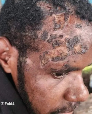 Tortured 19-year-old Gira Gwijangge