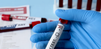 HIV outbreak in Fiji