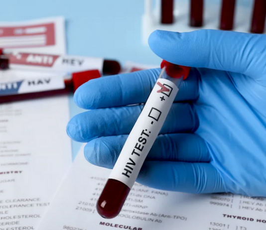 HIV outbreak in Fiji