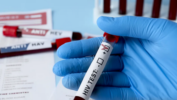 HIV outbreak in Fiji