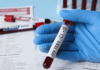 Thirty two newborns in Fiji have been diagnosed with HIV