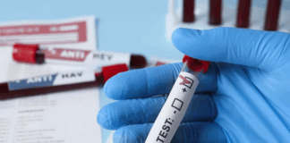 Thirty two newborns in Fiji have been diagnosed with HIV