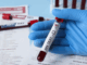 Thirty two newborns in Fiji have been diagnosed with HIV