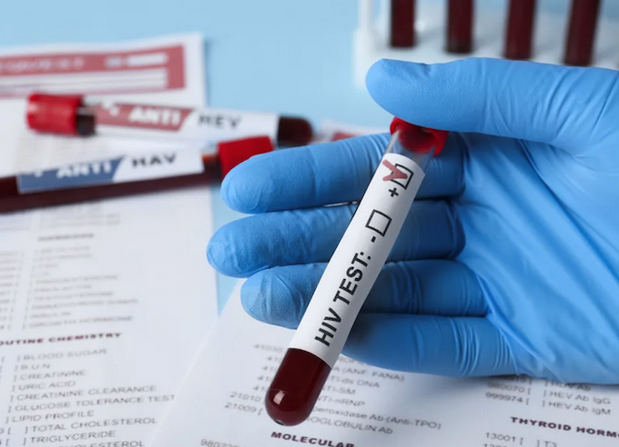 HIV test RNZ 680wide Thirty two newborns in Fiji have been diagnosed with HIV
