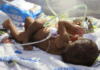 ‘We’re running out of time’: PNG parents in desperate plea to save conjoined twins PNG's conjoined twins