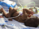 ‘We’re running out of time’: PNG parents in desperate plea to save conjoined twins PNG's conjoined twins