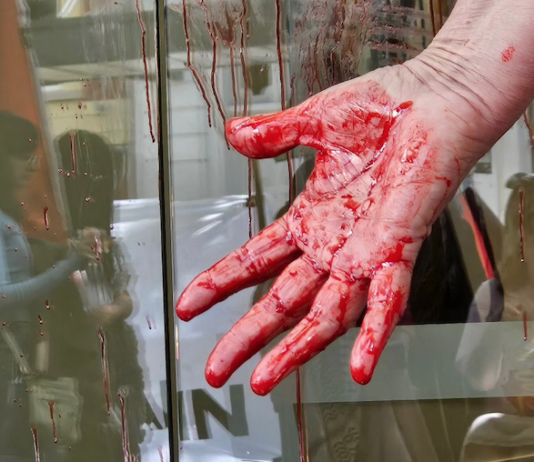 The "Blood on your hands" protest at the US Consulate