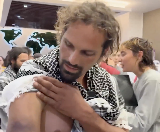 An Australian Gaza flotilla activist shows off the bruising on his arm from a beating from the Israeli prison guards