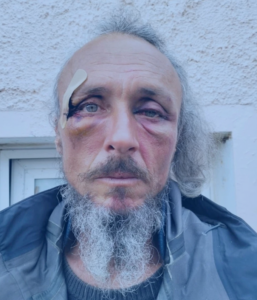 Julien Blondel’s face . . . bloodied but unbowed