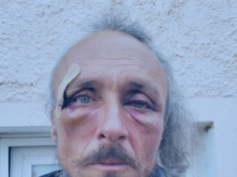 Julien Blondel’s face . . . bloodied but unbowed