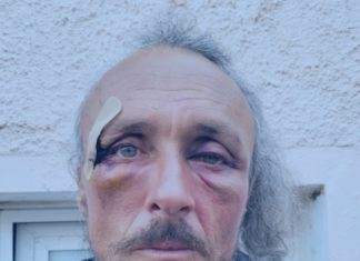 Julien Blondel’s face . . . bloodied but unbowed