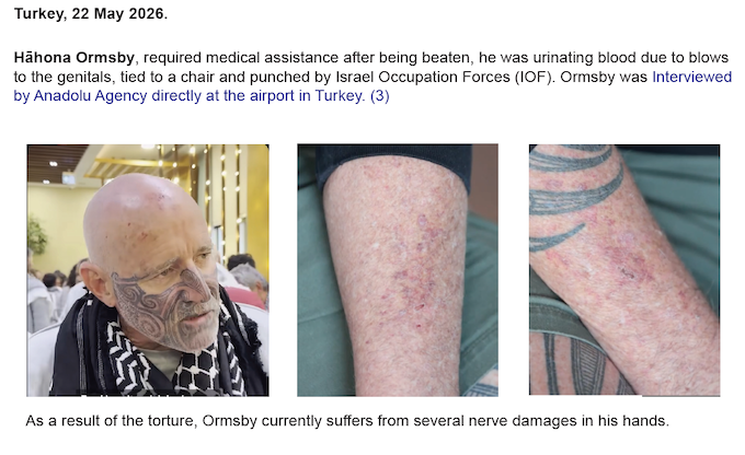 An extract from the Global Sumud Aotearoa Delegation dossier of allegations of abuse, beatings and torture against the Israeli military