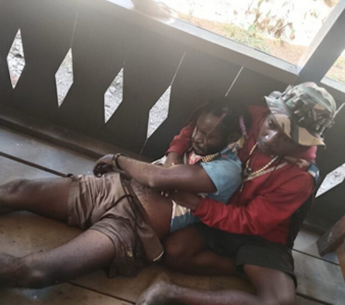 Wounded Papuan ULMWP 680wide A Papuan casualty on Monday